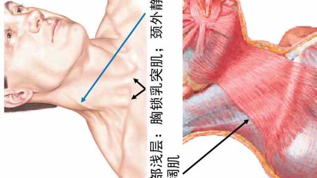 颈部表面解剖学