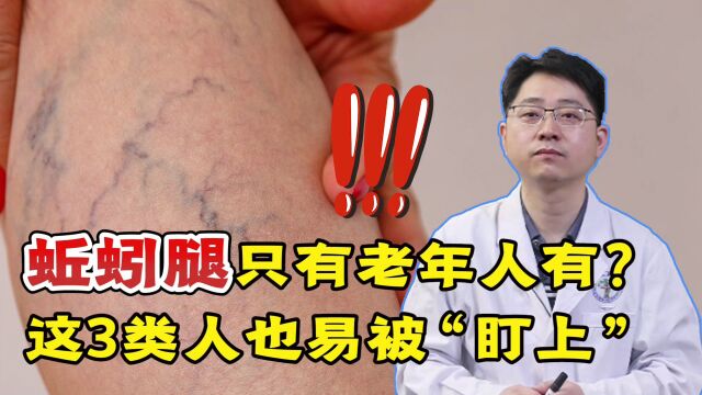 “蚯蚓腿”只有老年人会有?提醒:这3类人也易被盯上,提高警惕