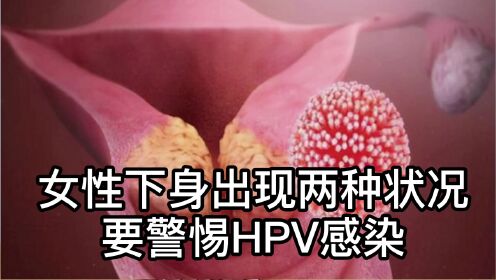 女性下身出现两种状况，要警惕HPV感染