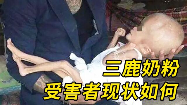 被三聚氰胺毒害的30万孩子,现在怎么样了?终身后遗症苦不堪言!