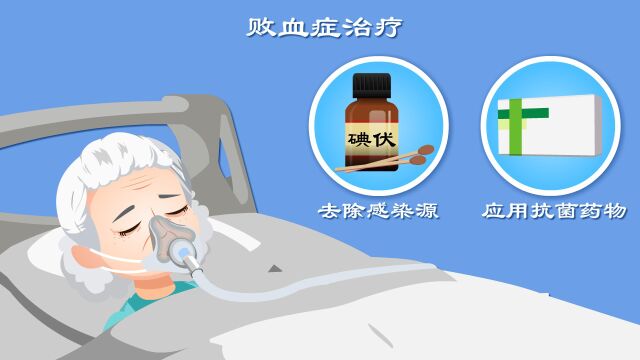 高病死率败血症能治吗?《败血症》合集全解读