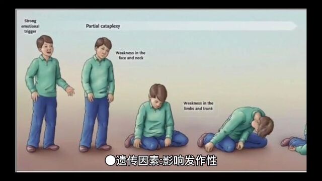 发作性睡病(基本病因二)