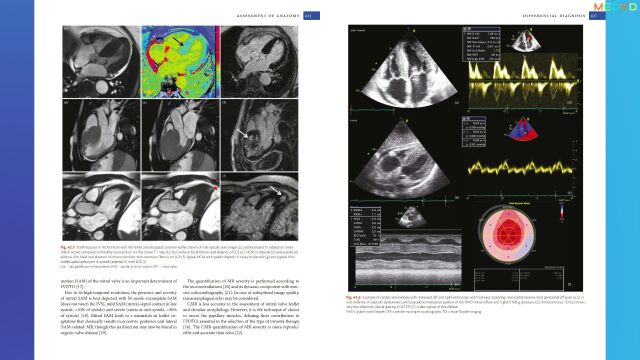 书简:ESC心血管成像教科书The ESC Textbook of Cardiovascular Imaging