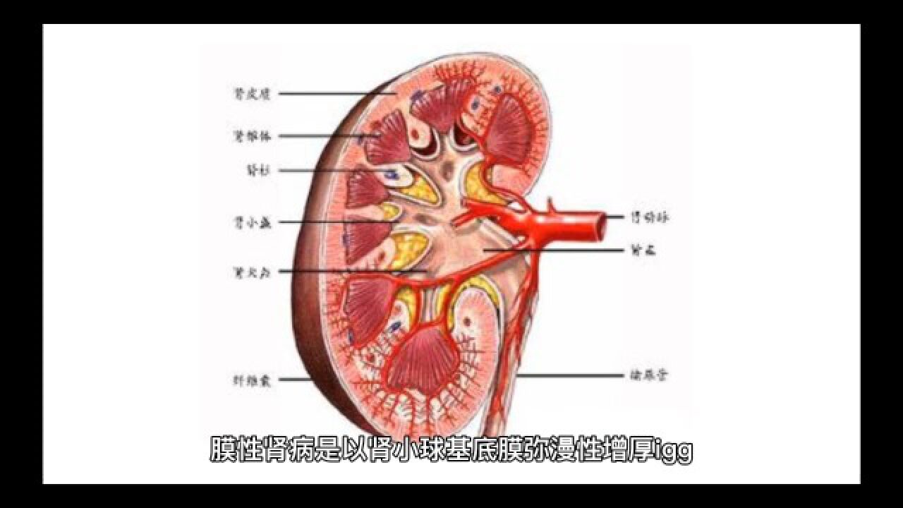 膜性肾病的治疗应注意哪些方面