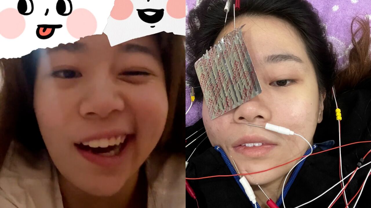 女生熬夜打游戏,一早醒来发现脸歪嘴斜成面瘫:再也不敢熬夜了!