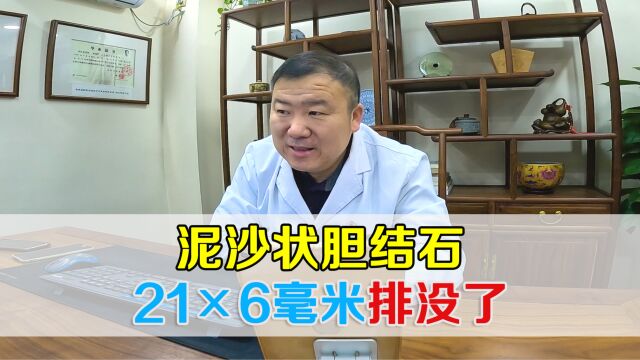 看诊:泥沙状胆结石21*6毫米,疏肝利胆3个月,结石全部排出