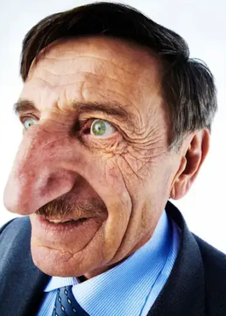 世界上鼻子最长的人去世了,鼻长88厘米相当一张扑克