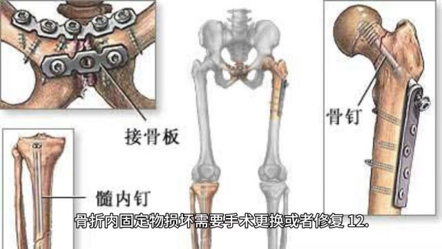 伤情坚定轻伤二级是什么