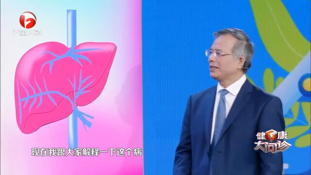 布加氏综合征多发于黄河下游流域,它到底是种什么病?