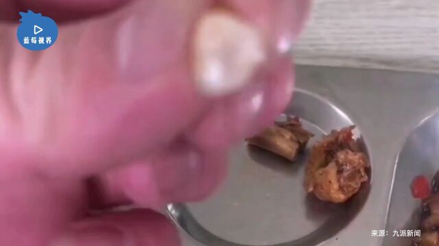 男子称在工厂食堂吃饭疑似在菜里吃到牙齿:反馈后公司说不是牙齿,像是骨头类的东西