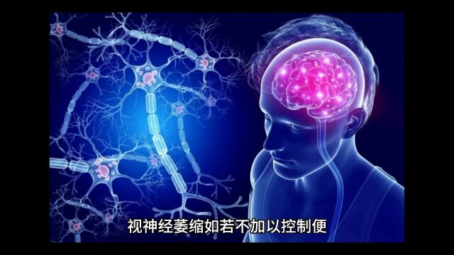 视神经萎缩视野缺损有哪些表现?