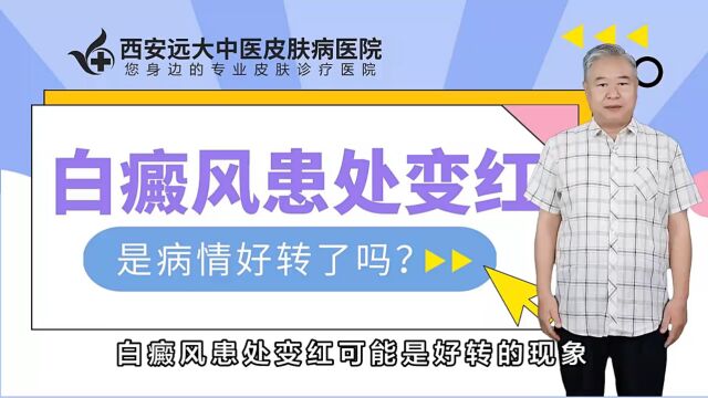 西安看白癜风专科医院西安远大白癜风医院白癜风患处变红是病情好转了吗