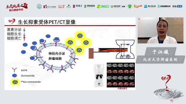 神经内分泌肿瘤,如何运用经典通路