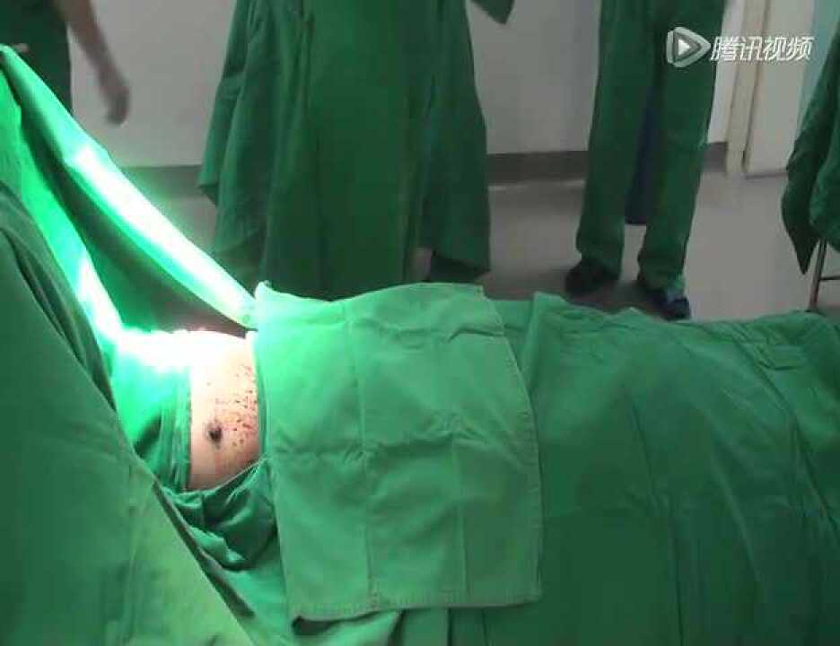 隆胸手术视频-深圳博爱整形刘波主任铺单.wmv_高清