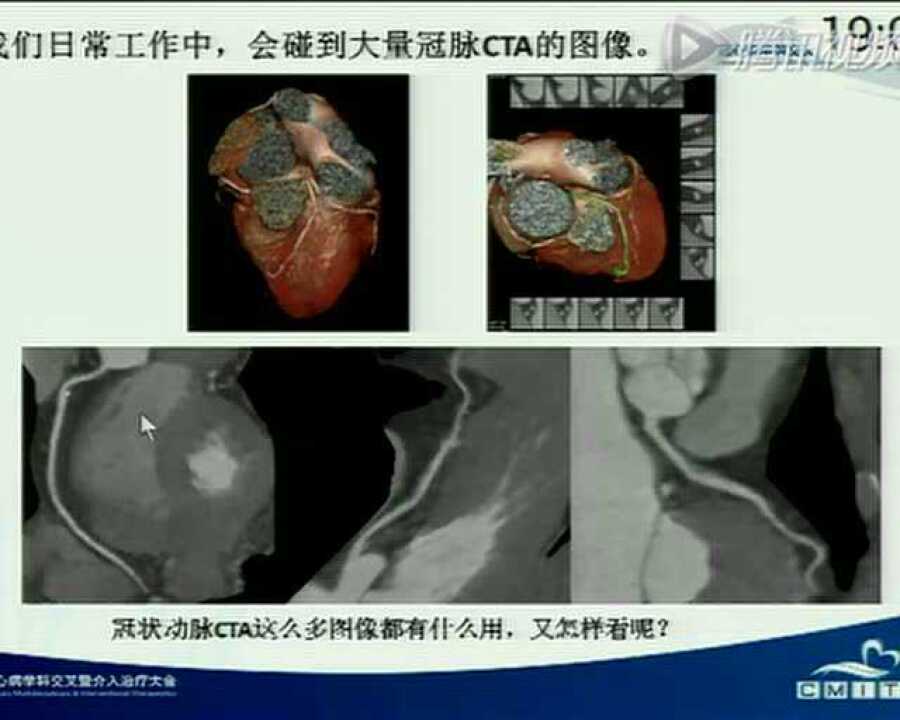 高清1080P在线观看平台_腾讯视频