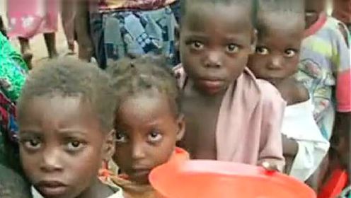 非洲忍受饥饿的儿童 伸出援助之手帮助他们！