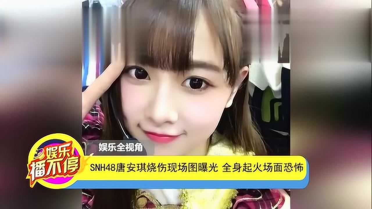 snh48唐安琪烧伤现场图曝光全身起火场面恐怖