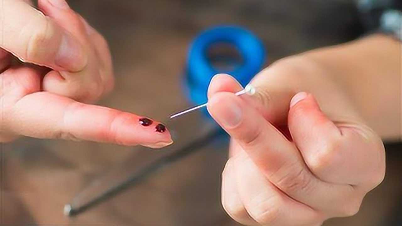 不小心手指扎刺,拿针挑很疼,教你一个小窍门,扎的刺自己蹦出来