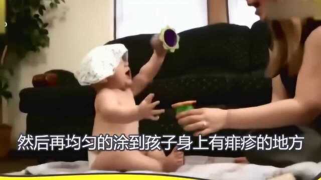 宝宝起痱子的正确护理方法,有效的小妙招快速去除痱子!宝妈学起来