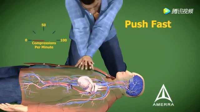 3d动画演示:胸外心脏按压急救原理