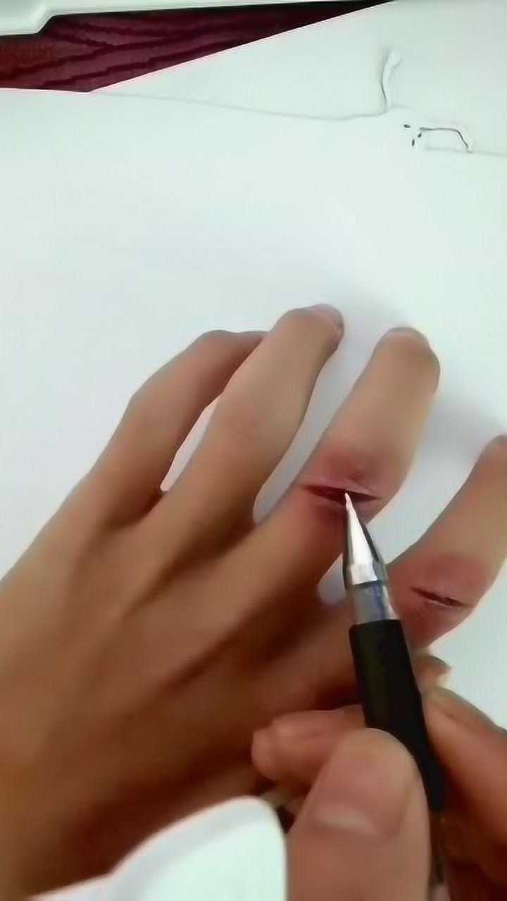 感染伤口简单易学教程绘画工具高光笔黑色笔白色笔红色笔