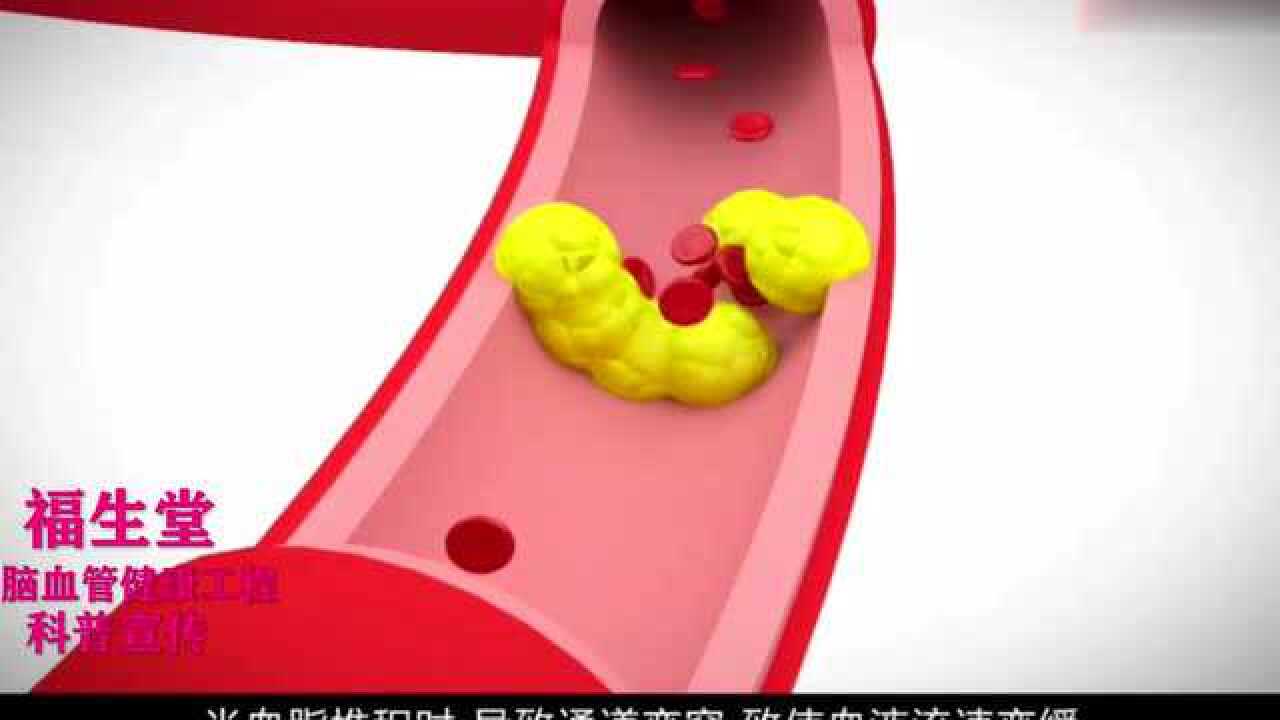 福生堂科普宣传血管之交通枢纽_腾讯视频}