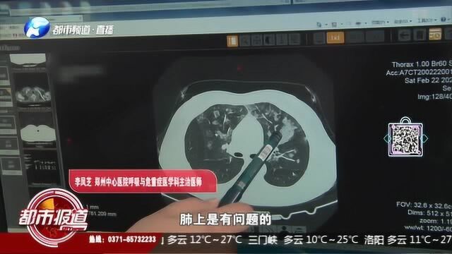 郑州女子 喷84进了医院——肺部出现毛玻璃影!