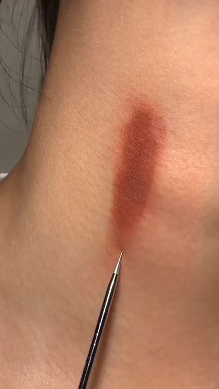 脖子上掐痕太尴尬了