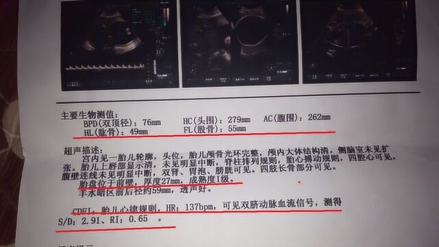 B超单上“藏”着宝宝性别,你一定不知道!尽早打开看!