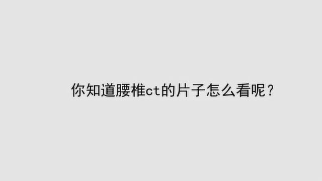 你知道腰椎ct的片子怎么看呢?