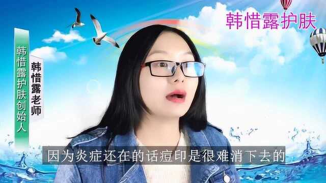 怎么去痘印,痘印怎么快速消除,韩惜露分享!