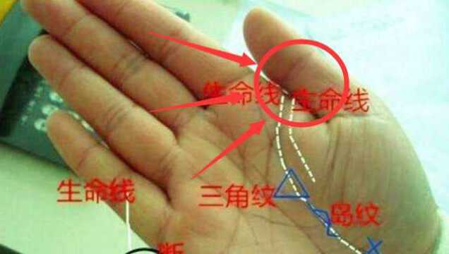 不管男女,只要大拇指上有“此纹”的人,迟早要“发大财”!