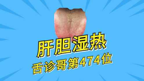 这类舌象是肝胆湿热的体现,那脾胃湿热和中焦湿热又有哪些表现呢