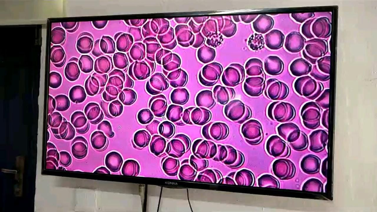 显微镜下的血液
