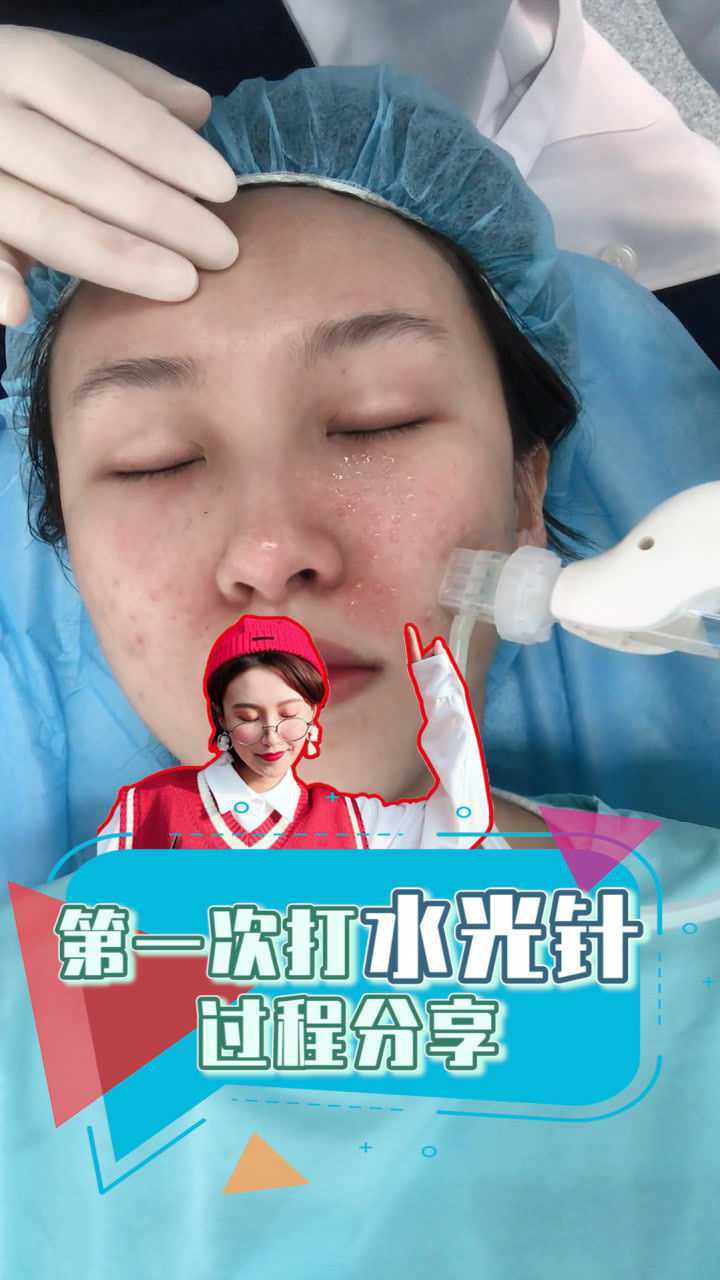 第一次打水光针过程分享