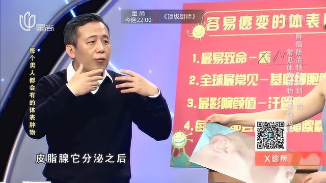 什么是皮脂腺囊肿?专家用图片解释,每个男人都会有