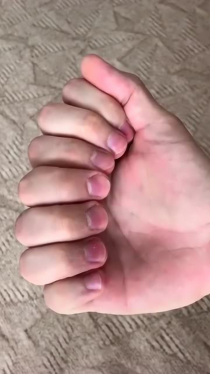 7根手指1根大拇指,认真盯着看吓我一跳,原来都是视觉错觉!