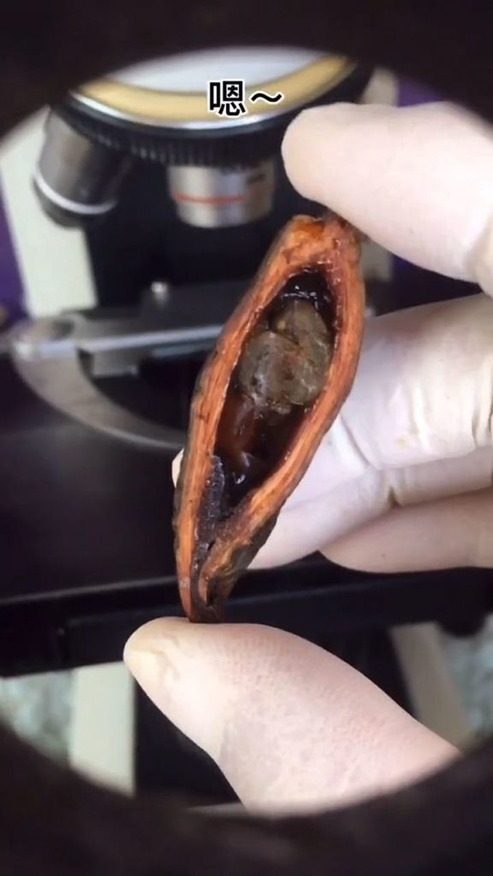 吃槟榔容易得口腔溃疡._腾讯视频