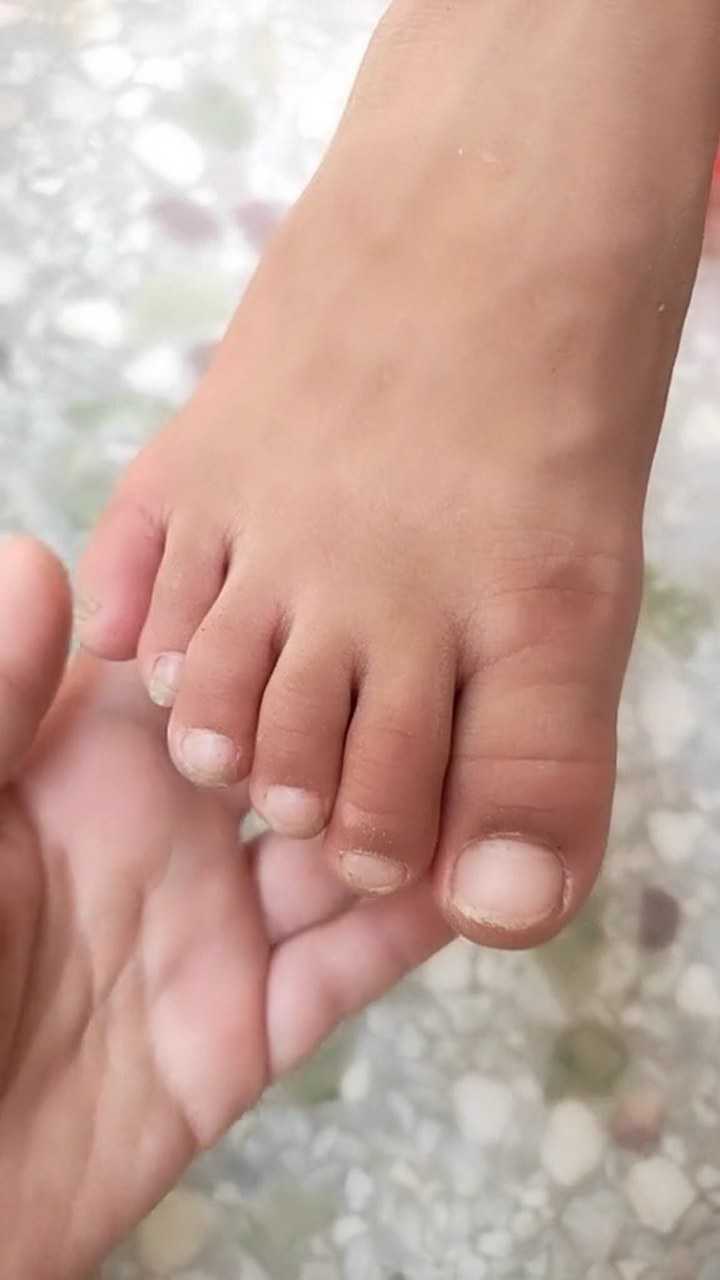 六个脚趾,你见过吗