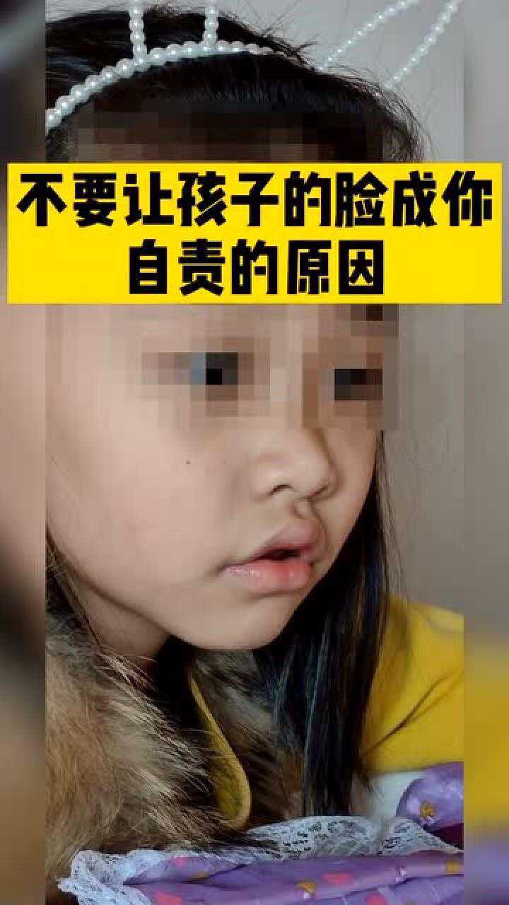 有种脸叫做腺样体面容作为家长你知道吗