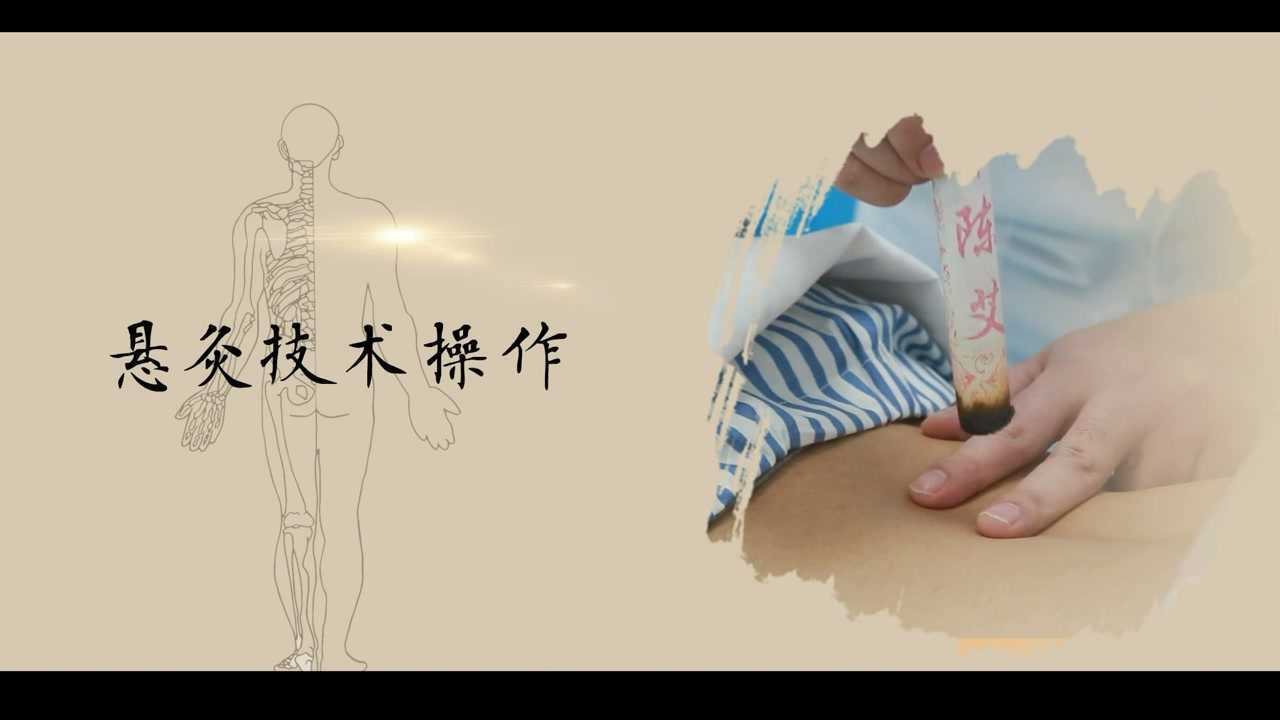 悬灸技术操作-孝感市中医医院_高清1080P在线观看平台_腾讯视频