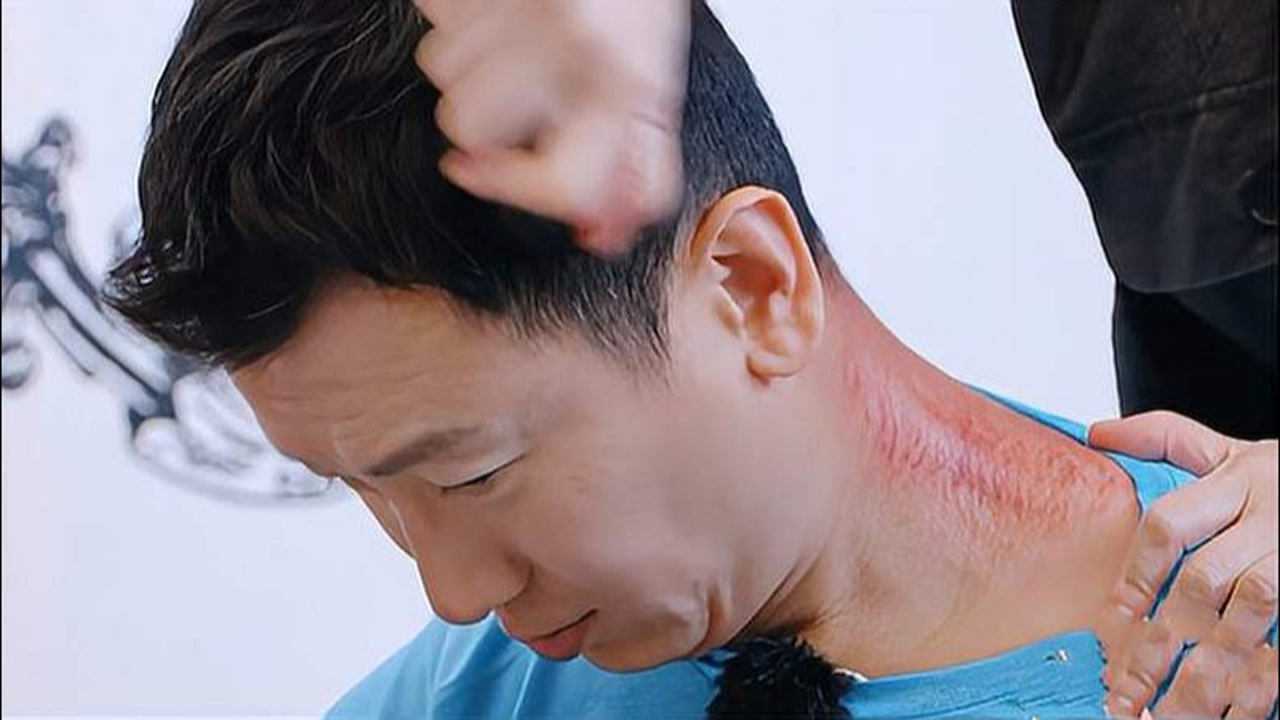 岳母帮黄柏俊刮痧,看到脖子上一条条红道子,表情瞬间凝固了!