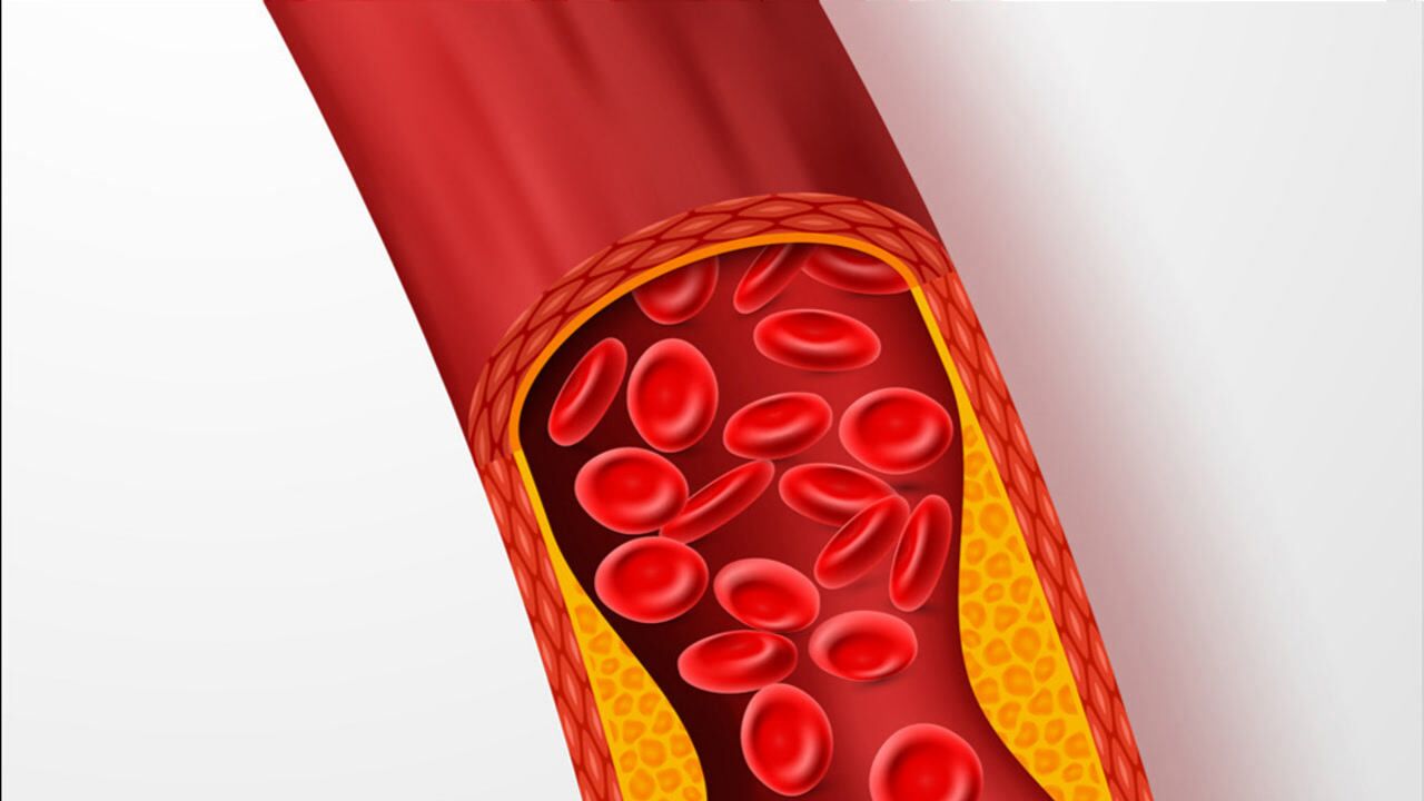 epa/dha在有心脑血管疾病中的作用