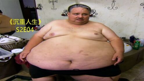 《沉重人生》S2E04,男子体重700斤，妻子却被要求做缩胃手术 ！
