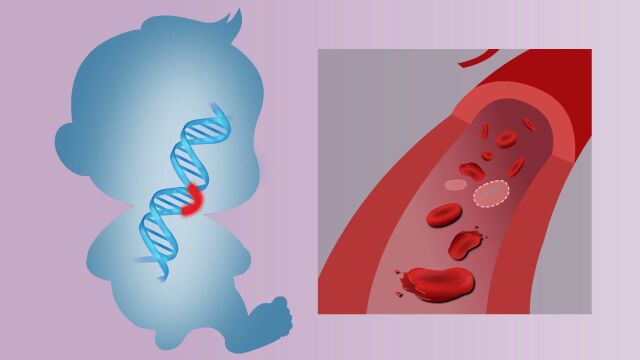 面色苍白?身材矮小?贫血、溶血咋发生?硬核动漫揭秘地贫致病基因