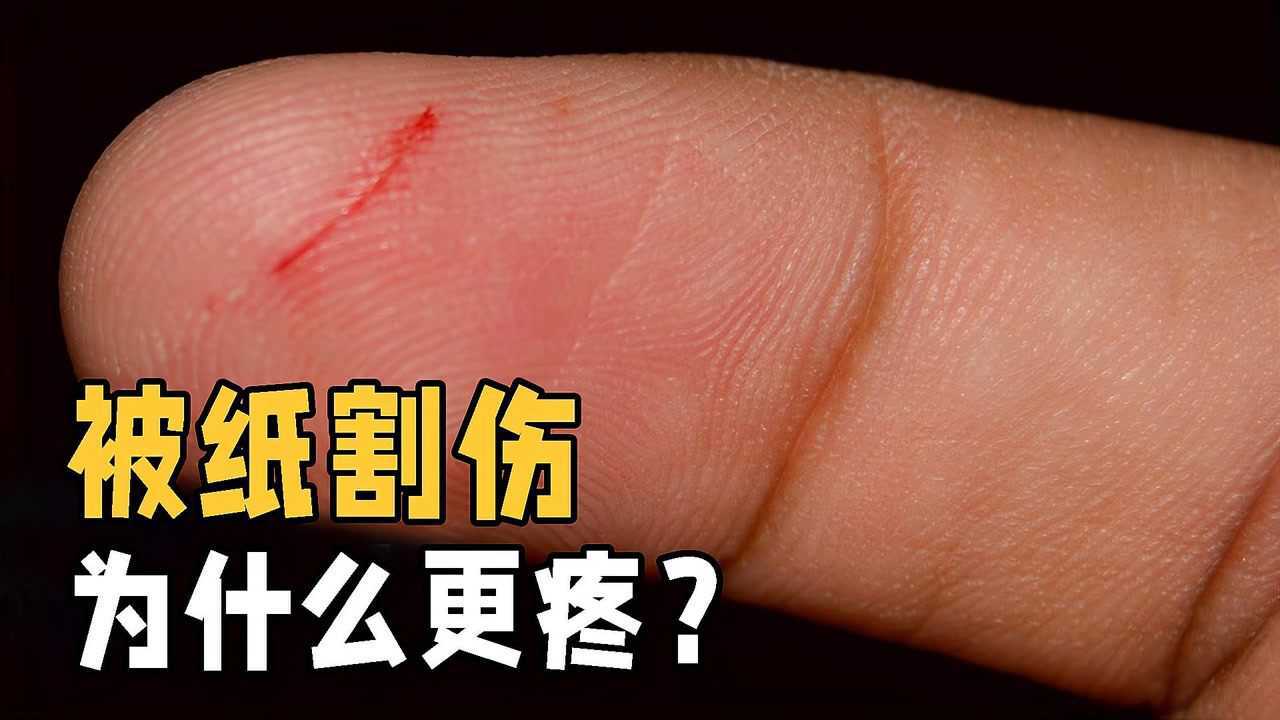 被一张柔软的纸割伤,为什么比被刀子划伤还要疼?看完涨知识了_腾讯视频