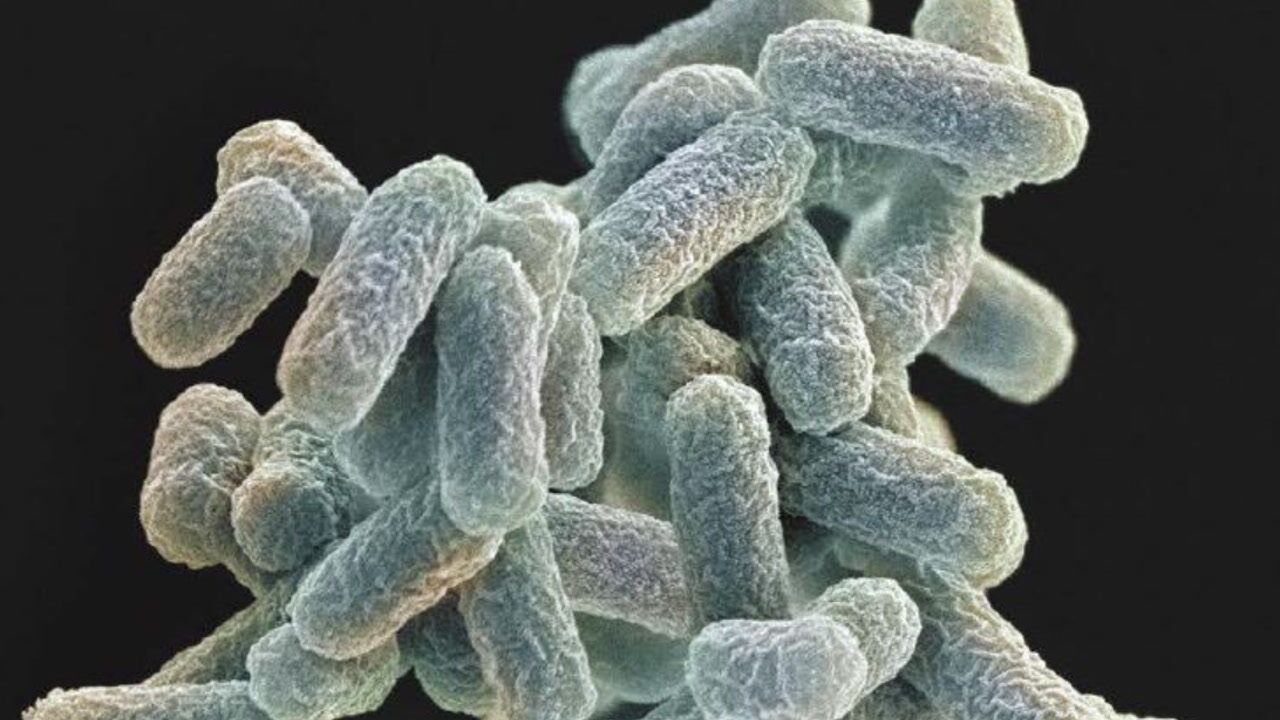 史前生物携带古老菌种,与现代有何区别?科学家:部分古菌可遗传_高清1080P在线观看平台_腾讯视频