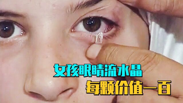 女孩眼睛流水晶,每颗价值百元,全家轻松过上小康生活?奇人异事