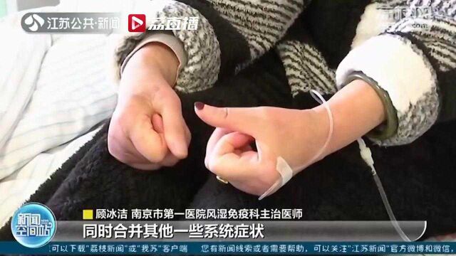 南京女子冬天手指发冷变白 竟是患了免疫疾病