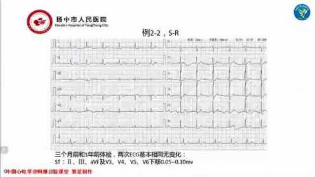 2022.01.18【漫话心电】第六十七期|鄂小青:追根溯源,探心你我他—网络传输心电图的应用体会